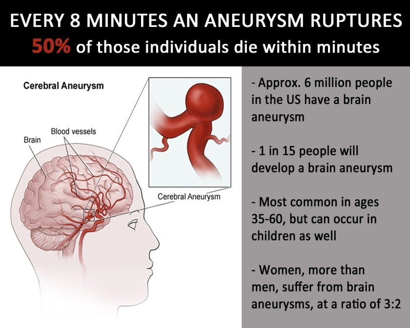 Just a few Brain Aneurysm facts.  The source can be found here.
